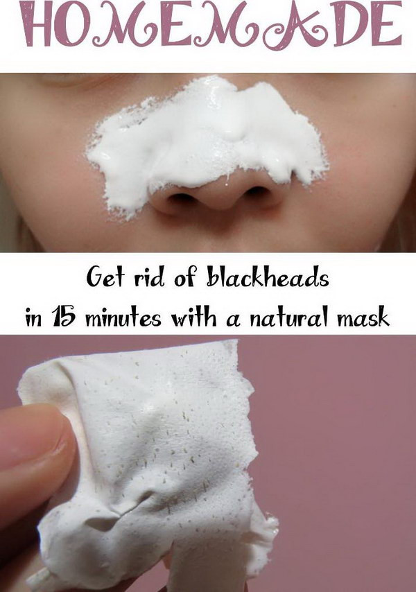 DIY Face Mask For Blackheads
 Homemade Blackheads Remover Tutorials and Ideas Hative
