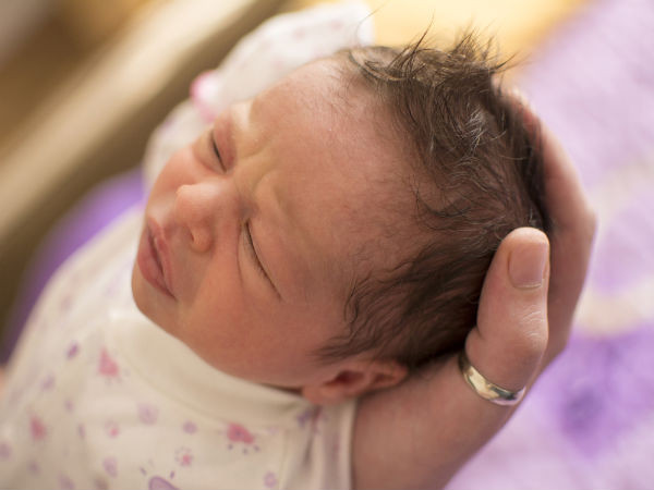 Baby Hair Falls Out
 Do Newborn Babies Suffer From Hair Loss Boldsky