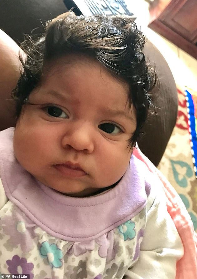 Baby Hair Falls Out
 Baby Ely Casillas born with full head of hair now sports 3