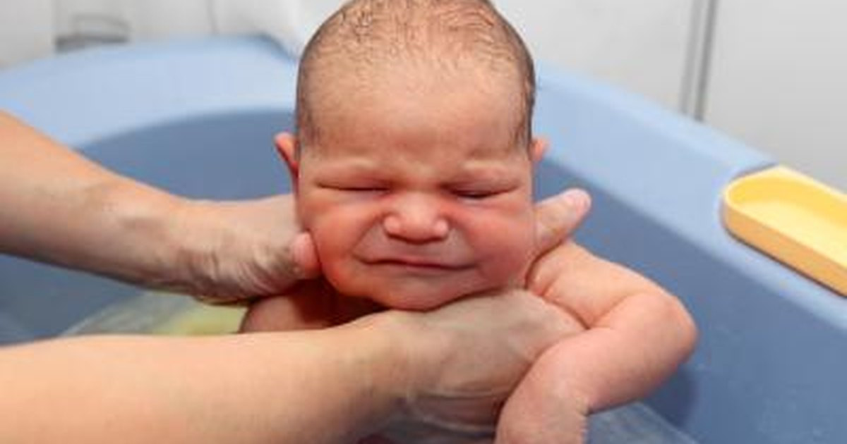 Baby Hair Falls Out
 Can Cradle Cap Make a Baby s Hair Fall Out