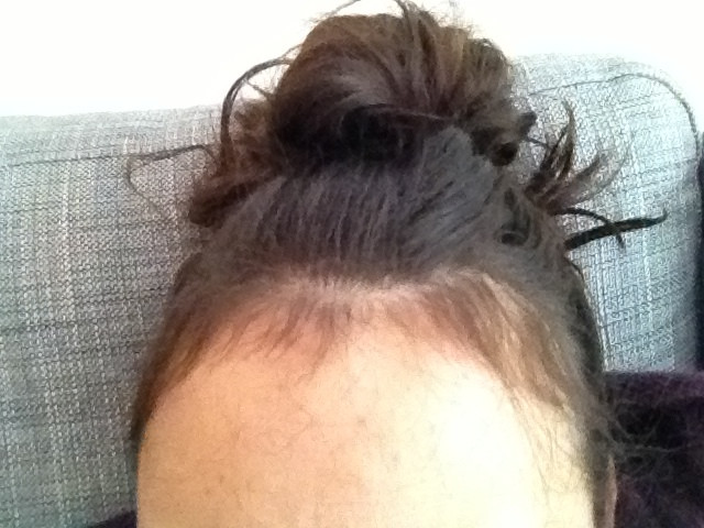 Baby Hair Falls Out
 Reality of being a Yummy Mummy Baby hairs after Pregnancy