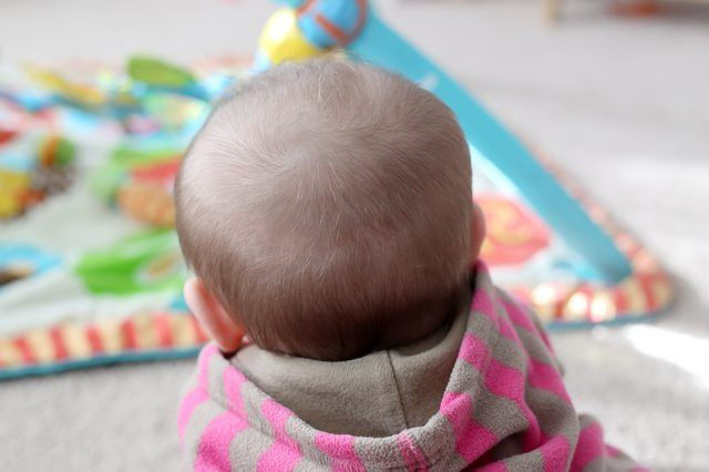 Baby Hair Falls Out
 How to Prevent a Bald Spot from Developing on the Back of