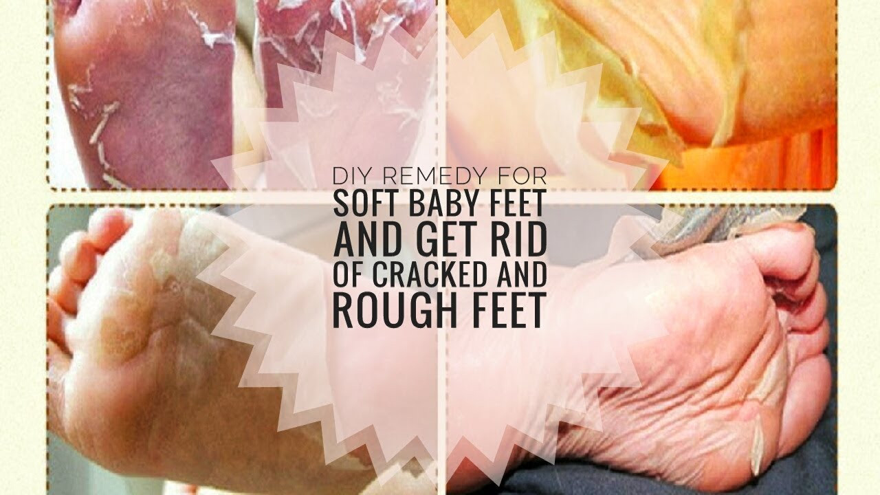 Diy Baby Foot Peel
 CHEAP DIY FOOT MASK PEEL FOR SOFT BABY FEET AND GET RID OF
