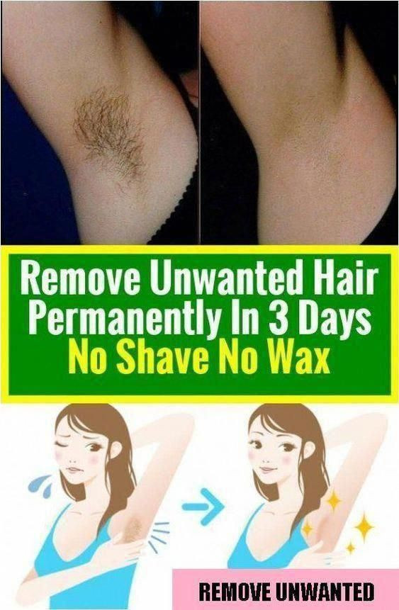 DIY Electrolysis Hair Removal
 Pin on how to remove unwanted hair