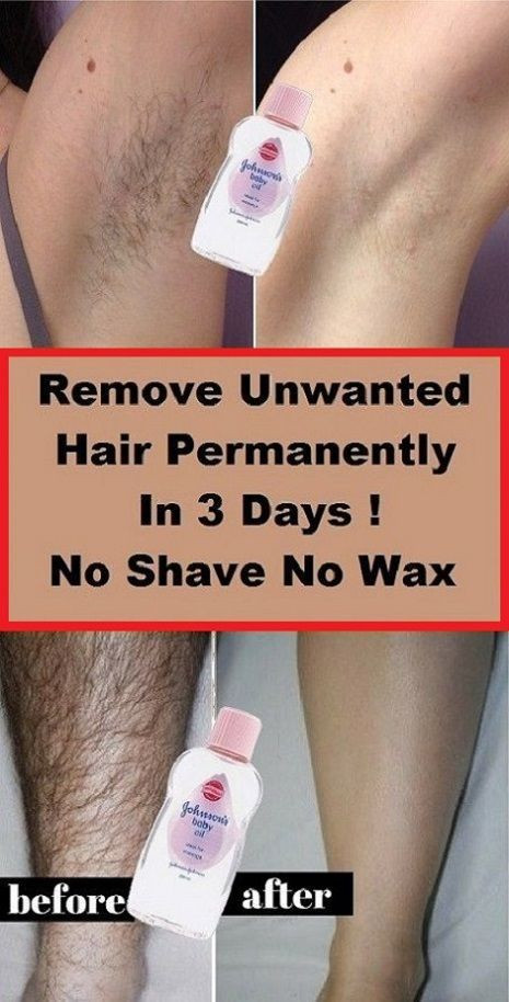 DIY Electrolysis Hair Removal
 Remove Unwanted Hair Permanently In Three Days No Shave