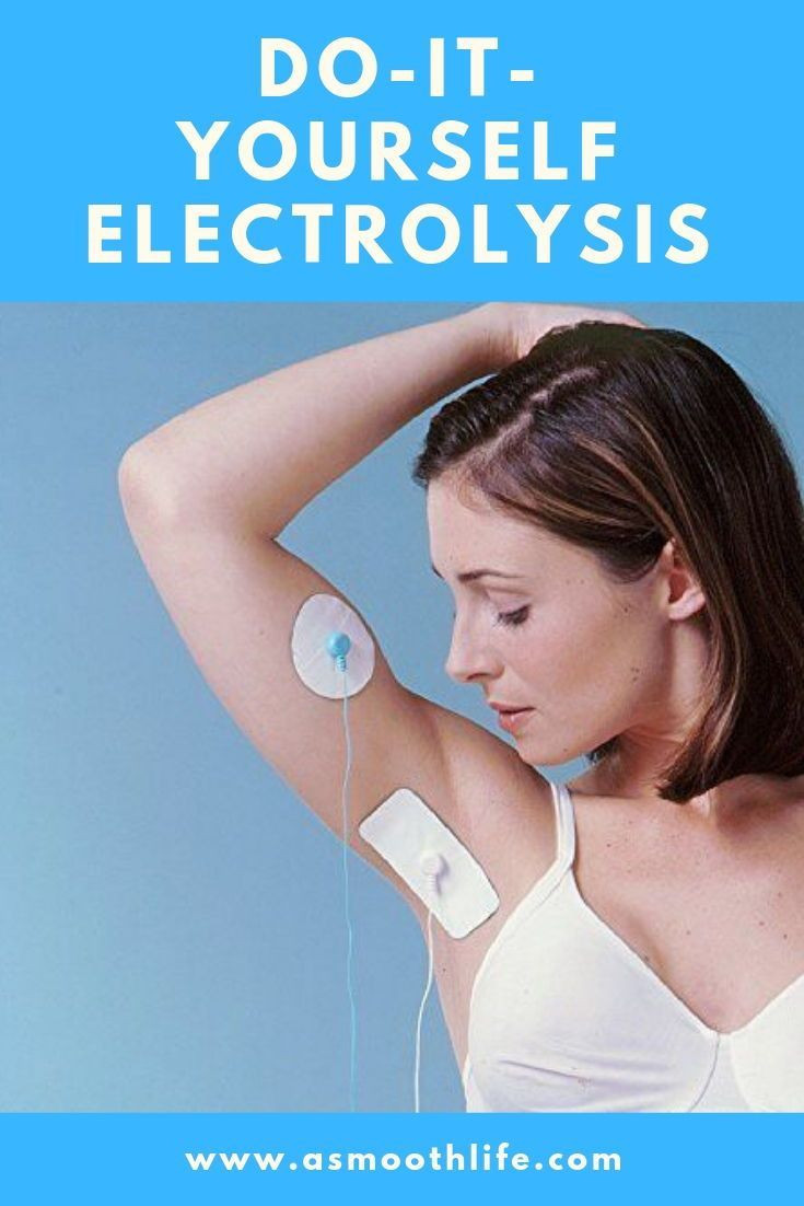 DIY Electrolysis Hair Removal
 Home Electrolysis Hair Removal Is electrolysis worth the