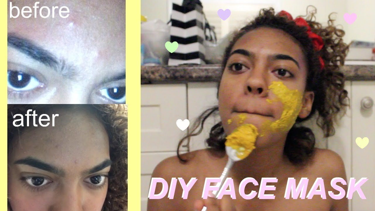 DIY Face Mask To Get Rid Of Acne
 DIY Face Mask To Get Rid Acne OVERNIGHT RESULTS