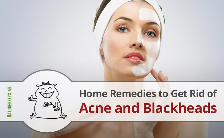 DIY Face Mask To Get Rid Of Acne
 Home Reme s to Get Rid of Acne and Blackheads