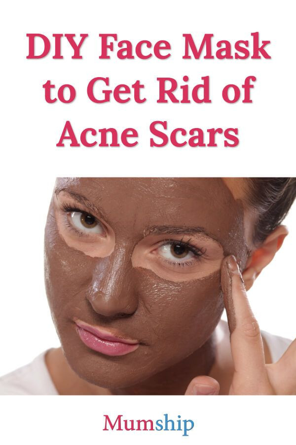 DIY Face Mask To Get Rid Of Acne
 The 23 Best Ideas for Diy Face Mask to Get Rid Acne