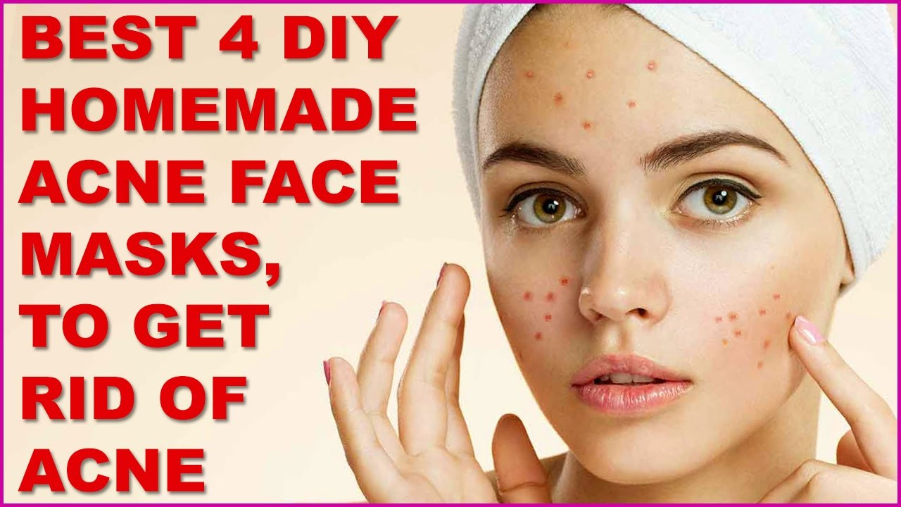 DIY Face Masks Acne
 Best 4 DIY Homemade Acne Face Masks To Get Rid Acne