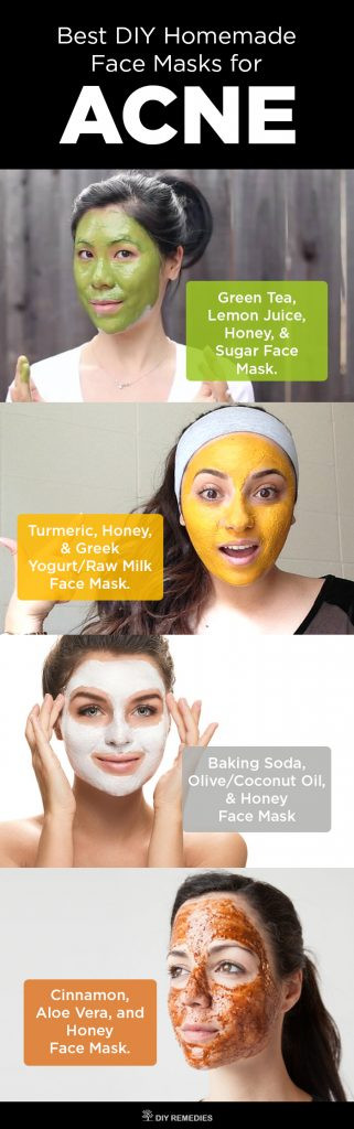 DIY Face Masks Acne
 6 Best DIY Homemade Face Masks for Acne