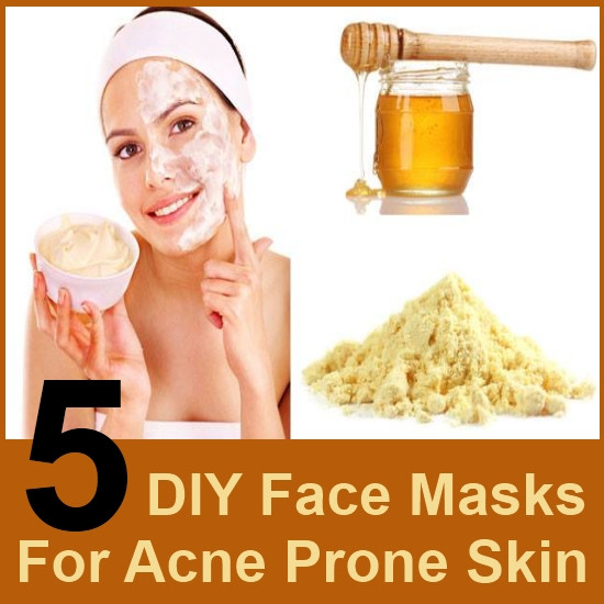 DIY Face Masks Acne
 5 DIY Face Masks For Acne Prone Skin
