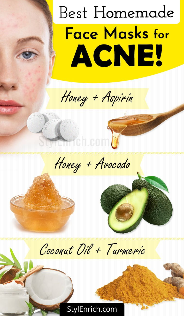 DIY Face Masks Acne
 Homemade Face Mask For Acne Treatment At Home