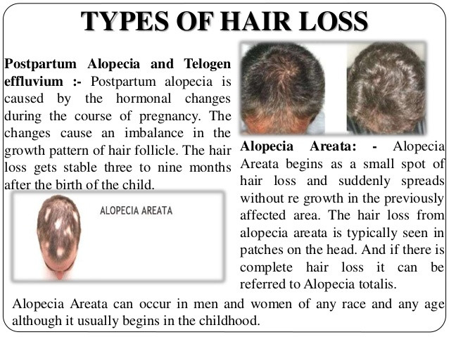 Hair Loss In Children Due To Stress
 Effective treatment of hair loss