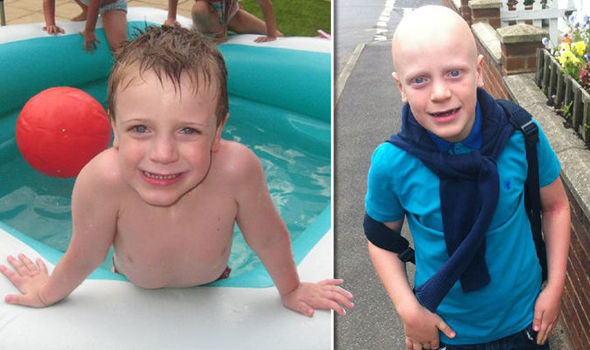 Hair Loss In Children Due To Stress
 Boy permanently BALD after stress brings on alopecia