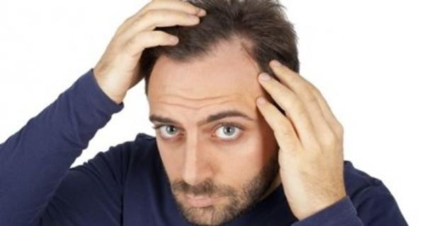 Hair Loss In Children Due To Stress
 Can stress cause hair loss Beauty query of the day