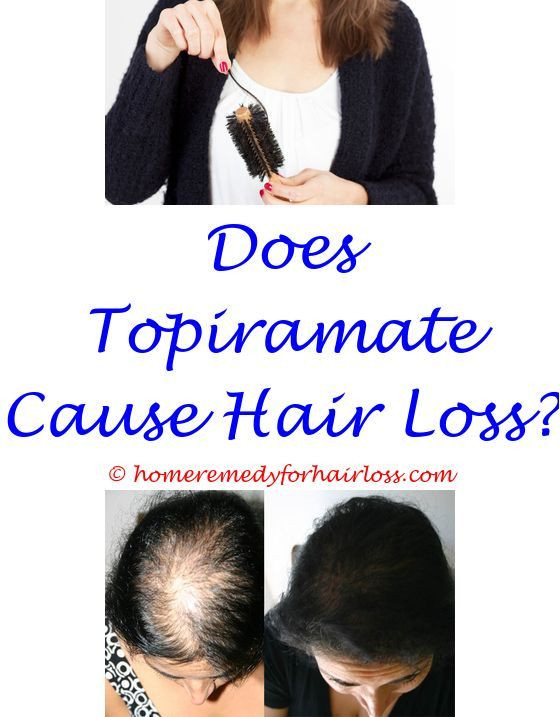 Hair Loss In Children Due To Stress
 hair loss due to stress symptoms correlation between